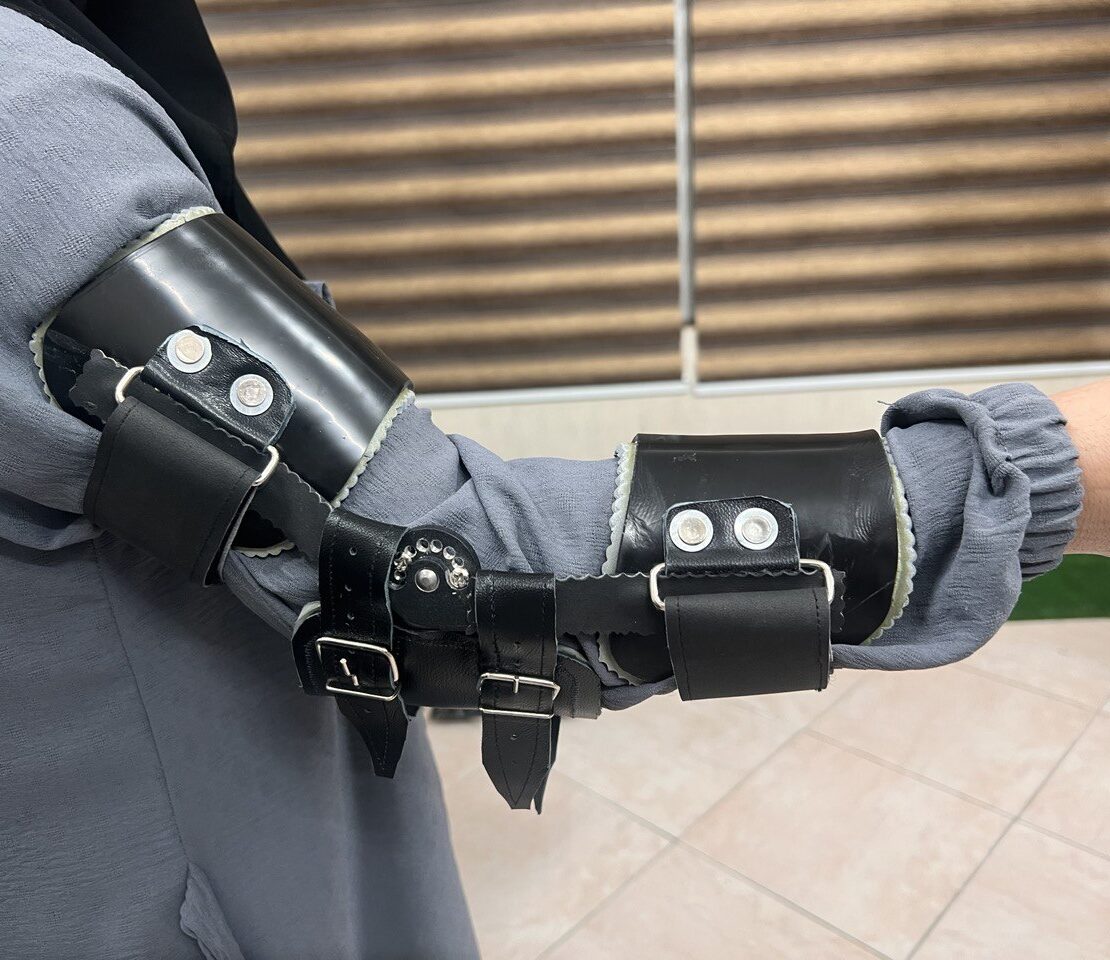 ارتوز آرنج