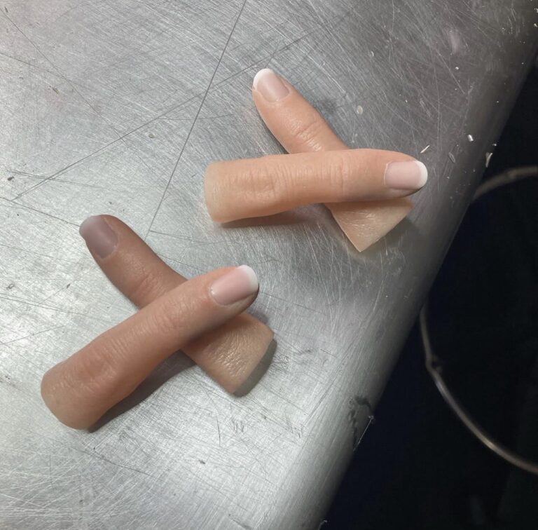 پروتز انگشت