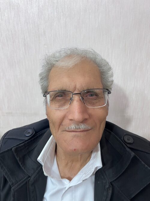 بعد از دریافت پروتز چشم