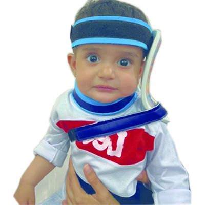 تورتوکولی بریس