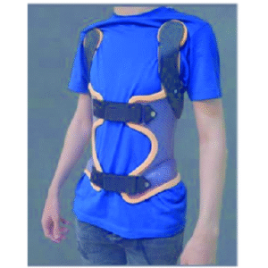 ارتوز kyphologic